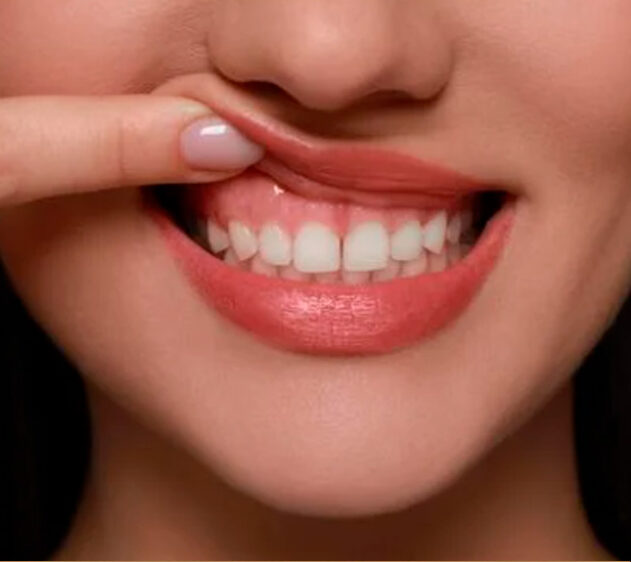 LORENA BARRETTO ODONTOLOGIA periodontista em petropolis