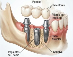 protese parcial fixa em petropolis LORENA BARRETTO ODONTOLOGIA em petropolis